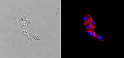 مجموعة جوالة من الخلايا البطانية المشتقة من ورم: على اليمين، تلوين مناعي متألّق للمجموعة بـCD13.